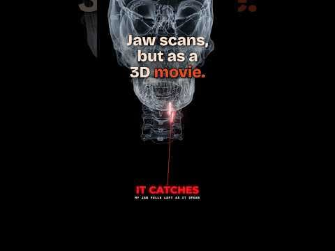 This guy couldn't make sense of his jaw scans, so he turned them into a 3D movie 🦴 #tmj #claudecode